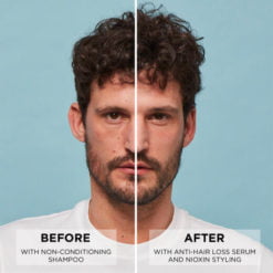 filemproductsproduct pageleave innioxin anti hair loss serum 2 djpg